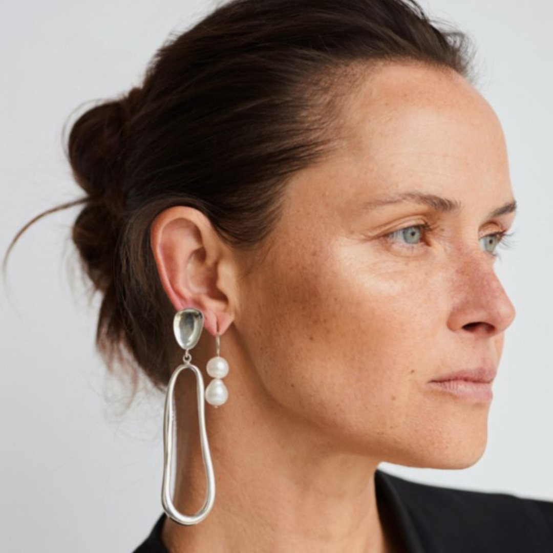 Пігментація: причини, прояви та дієве лікування – експертний розбір лікарів іО